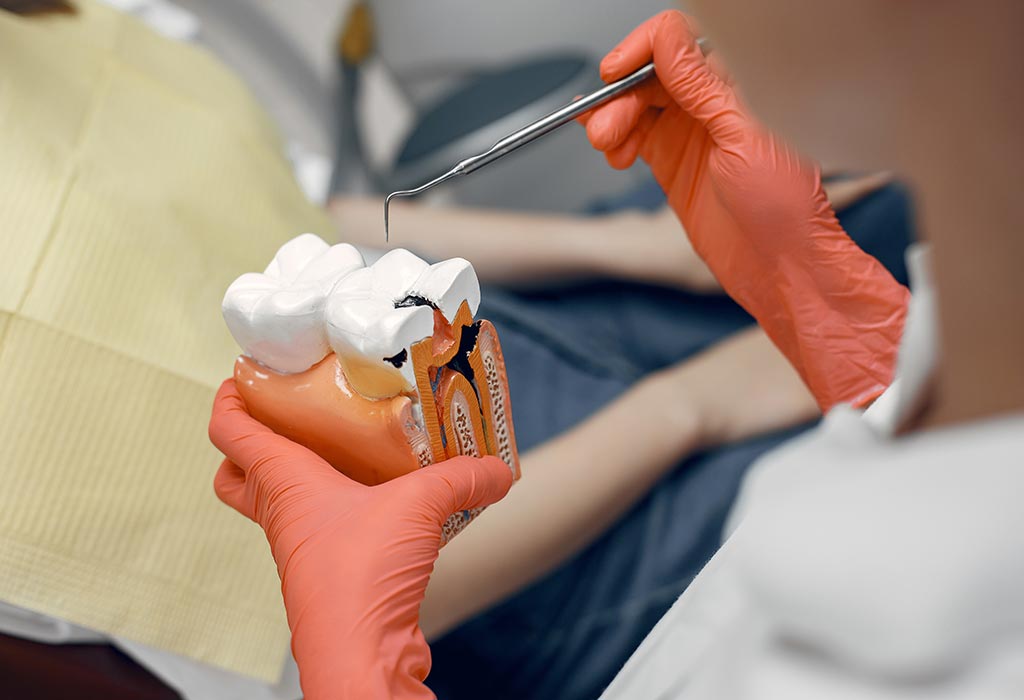 obturación dental
